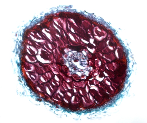 Ectomycorrhizae