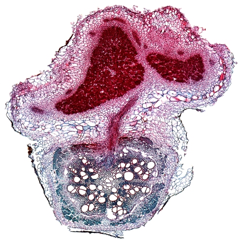 Rhizobium Nodule