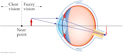 Walker4e Fig. 27-10